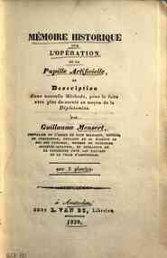*Mémoire historique sur l'opération de la pupille : et description d'une nouvelle méthode, pour la faire avec plus de sureté au moyen de la diplotomise / par Guillaume Mensert, ... 